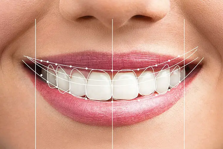 Lebih dari Sekadar Senyum Indah: Investasi Seumur Hidup dengan Full Mouth Rehabilitation